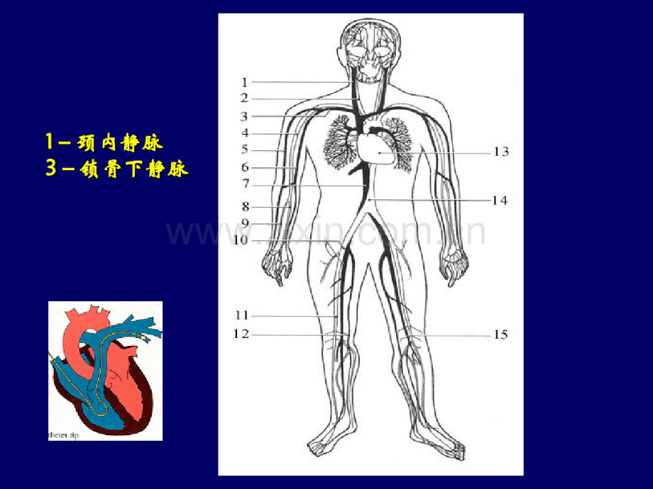 Swan-Ganz导管置入术.pdf_第2页