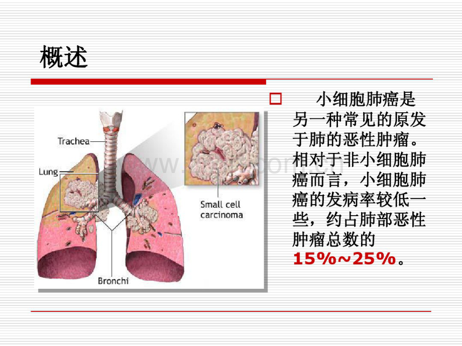 小细胞肺癌(20190717081049).pdf_第2页