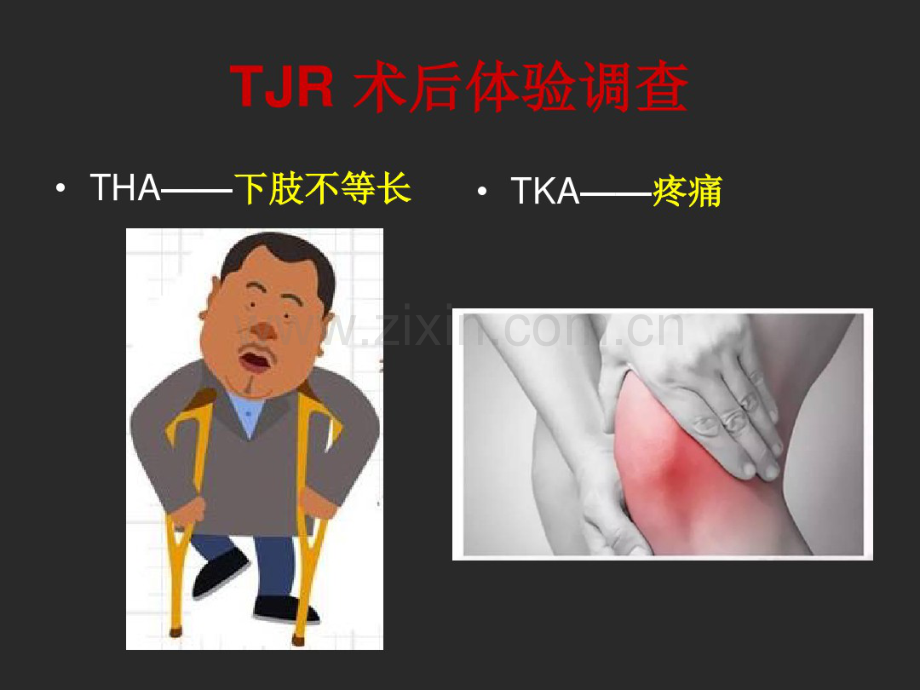 THAOffset重建与下肢长度.pdf_第2页