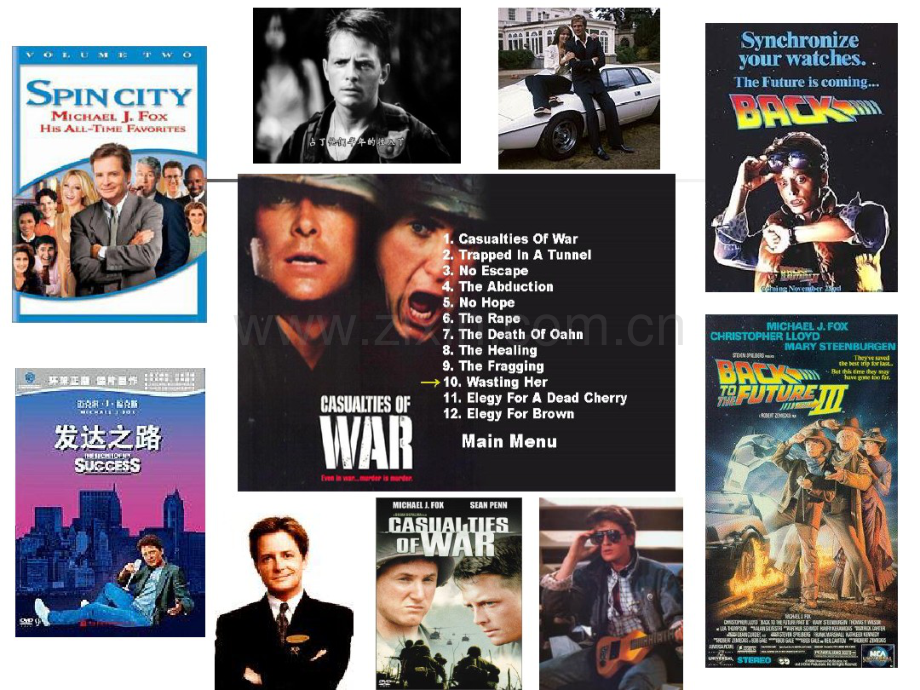 帕金森病的诊断-张巍-(2).pdf_第2页