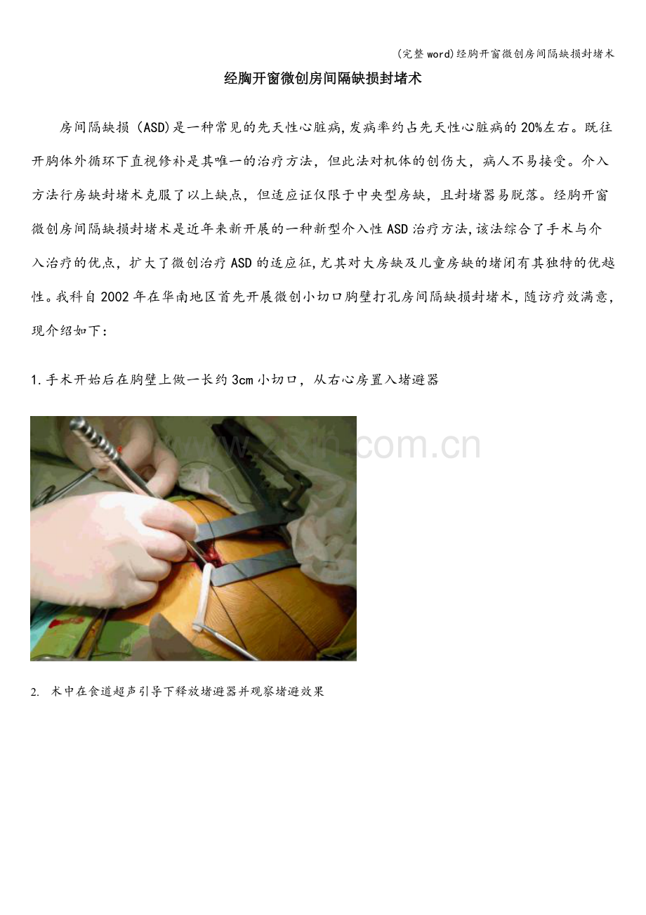 经胸开窗微创房间隔缺损封堵术.doc_第1页