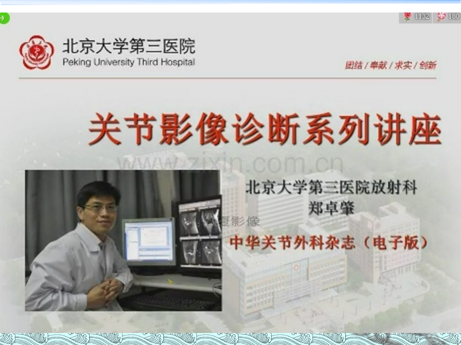 股骨头缺血坏死的磁共振诊断-郑卓肇.ppt_第1页