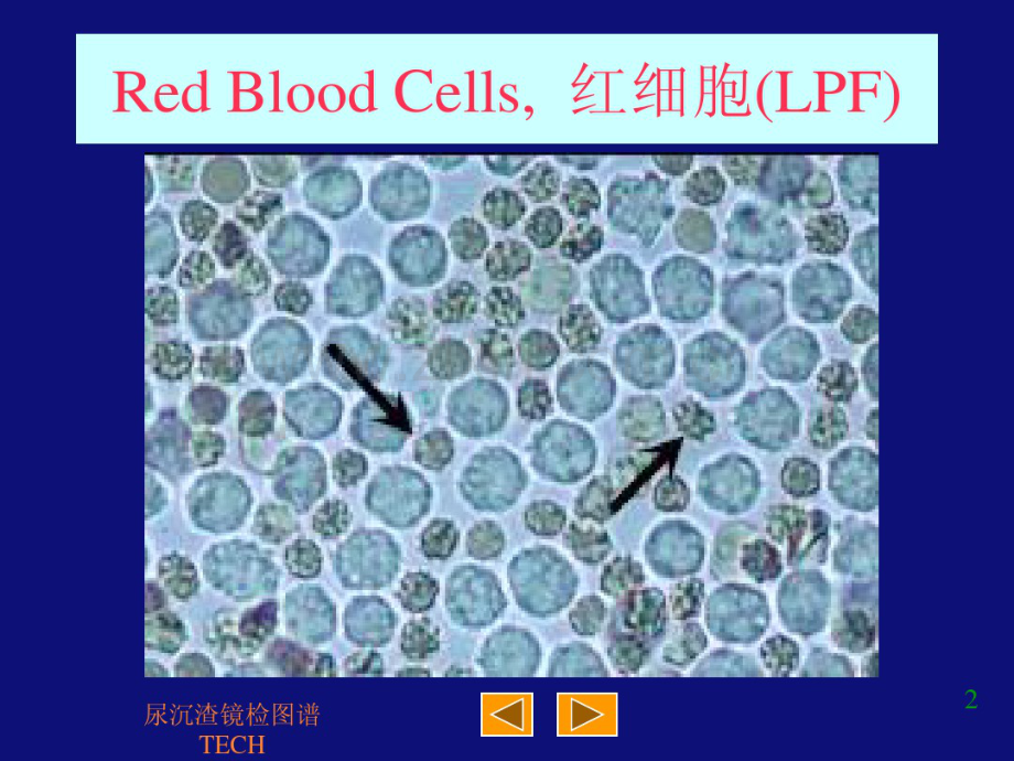 尿沉渣镜检图谱(tech).pdf_第2页