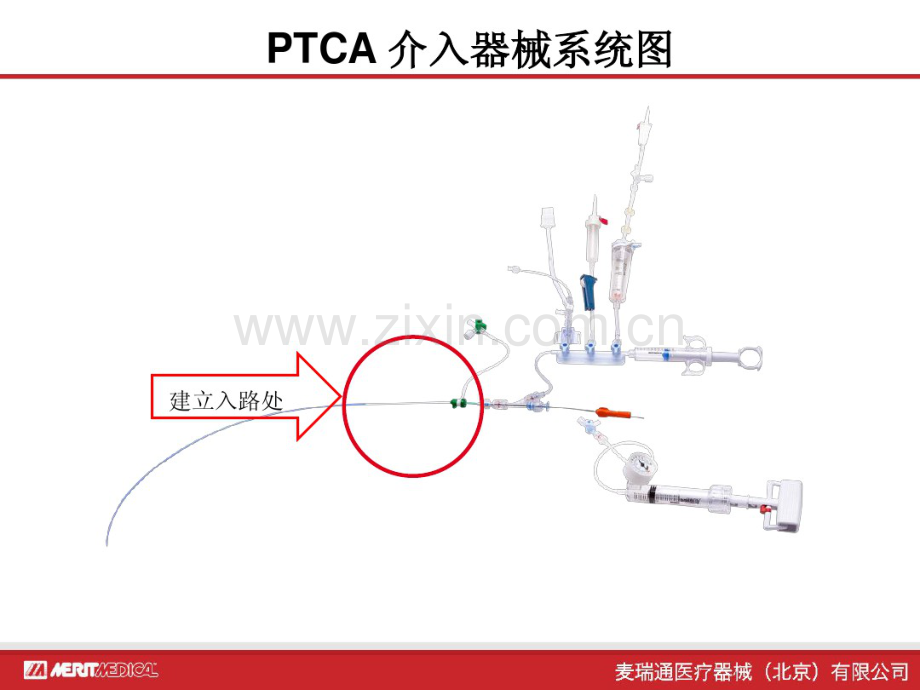 TrainingPPT冠脉介入手术入路介绍.pdf_第2页