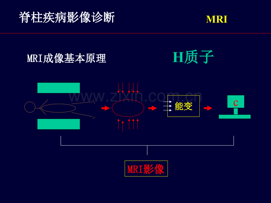 脊柱疾病MRI诊断.ppt_第2页