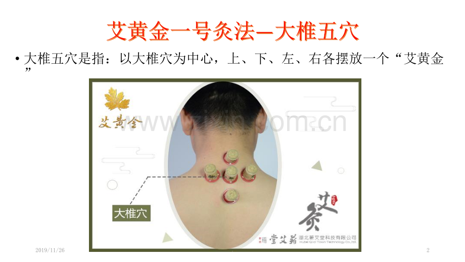 艾黄金八大特色灸法.ppt_第2页