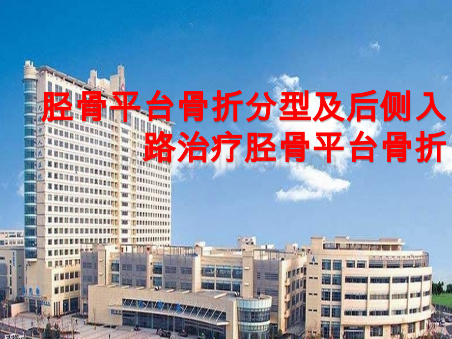 胫骨平台后侧柱骨折.pptx_第1页
