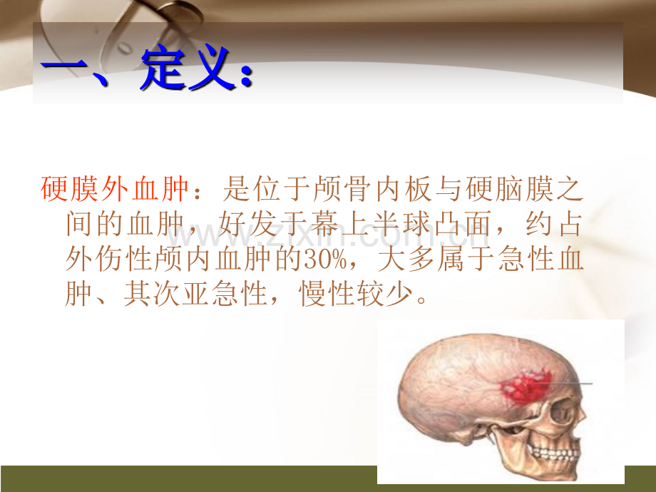 教学查房——创伤性硬膜外血肿演示课件.ppt_第2页