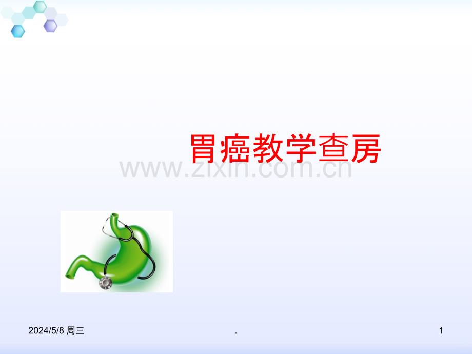 胃癌教学查房.ppt_第1页