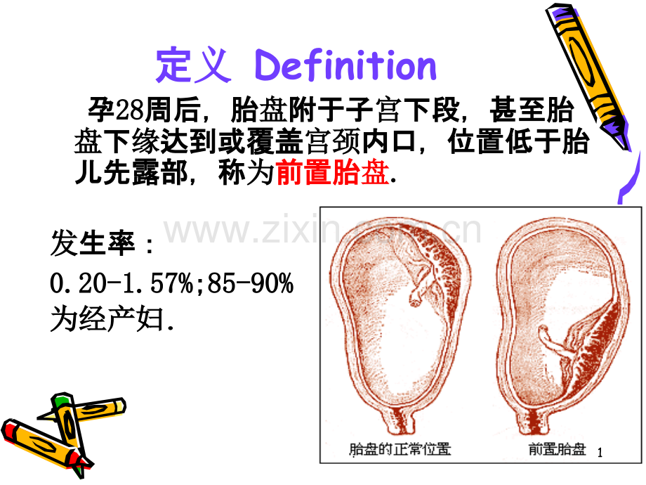 妊娠并发症前置胎盘胎盘早剥羊水过多过少.ppt_第1页