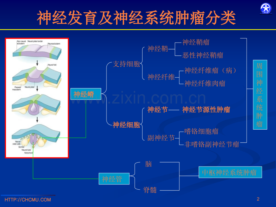 儿童腹膜后神经节源性肿瘤的影像诊断.ppt_第2页