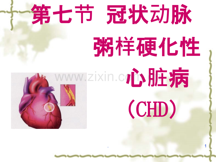 心脏硬化性心脏病.ppt_第1页