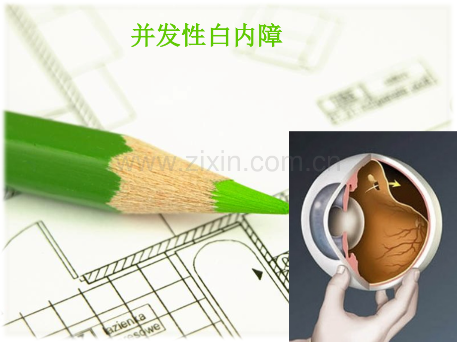 并发性白内障.ppt_第1页