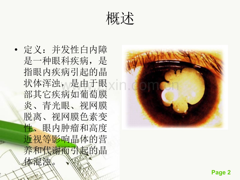 并发性白内障.ppt_第2页