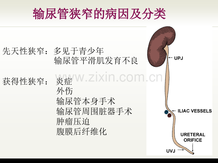 球囊扩张-张军晖.ppt_第2页