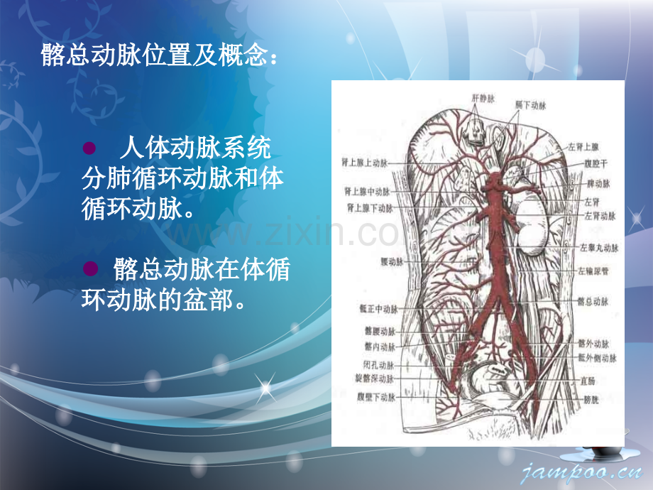 髂总动脉闭塞.ppt_第2页