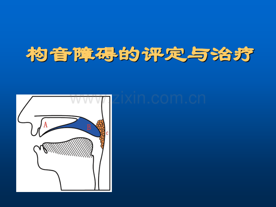 构音障碍评定与治疗.ppt_第1页