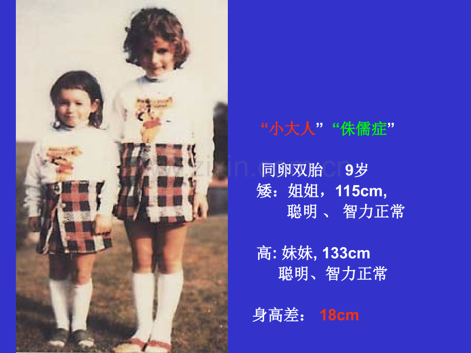 儿科学之生长激素缺乏症.ppt_第2页