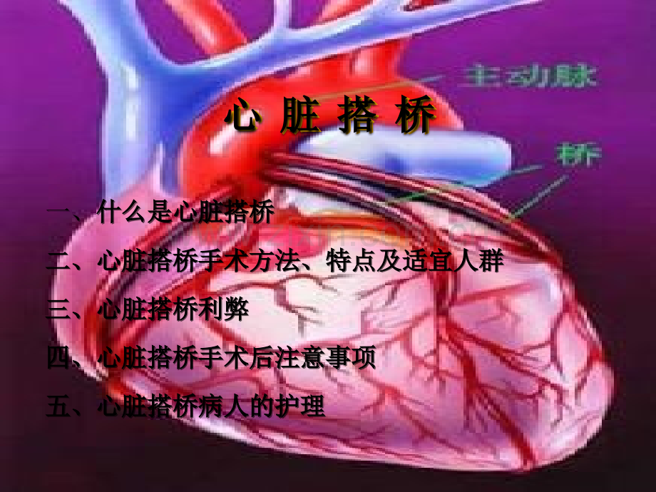 心脏搭桥术后护理.ppt_第2页