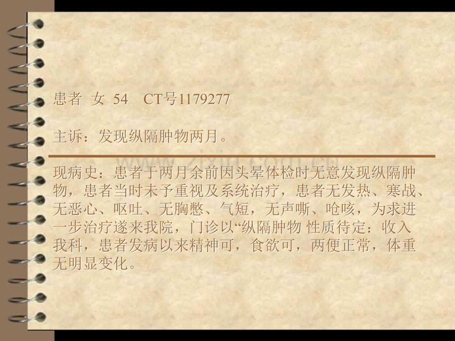 前纵隔支气管囊肿.ppt_第2页