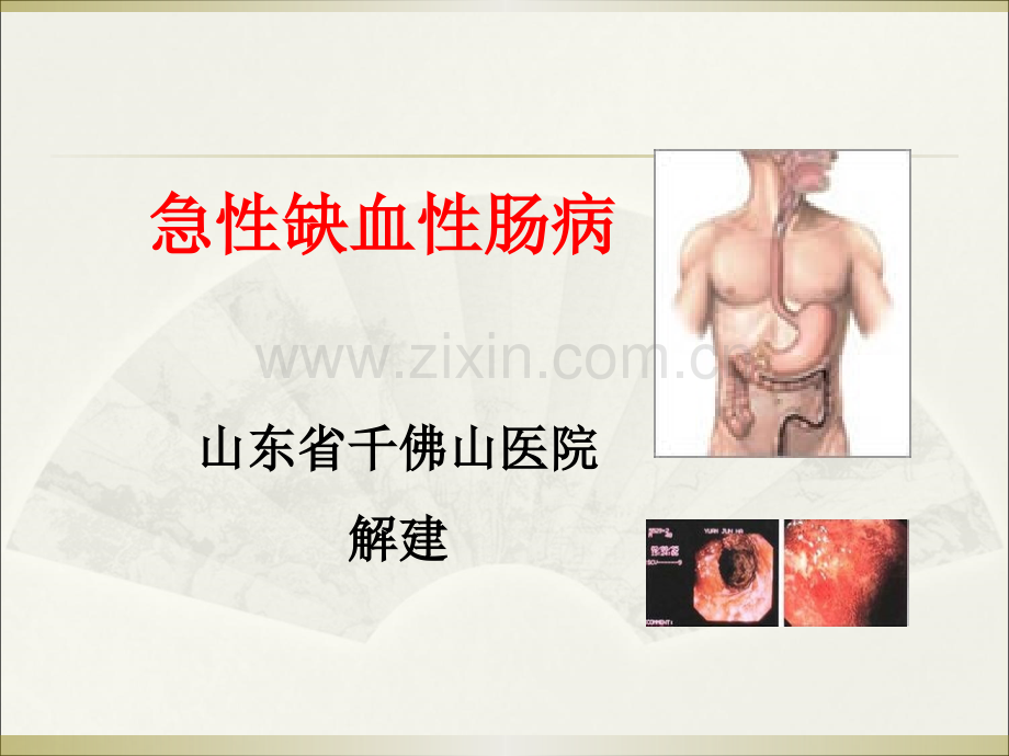 缺血性肠病!.ppt_第1页