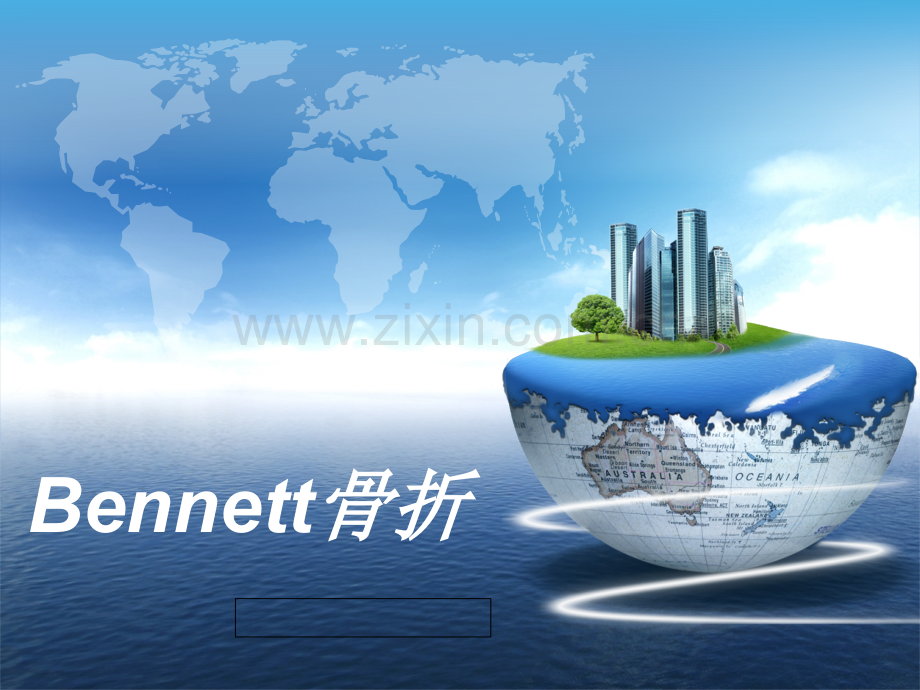 bennett骨折-.ppt_第1页