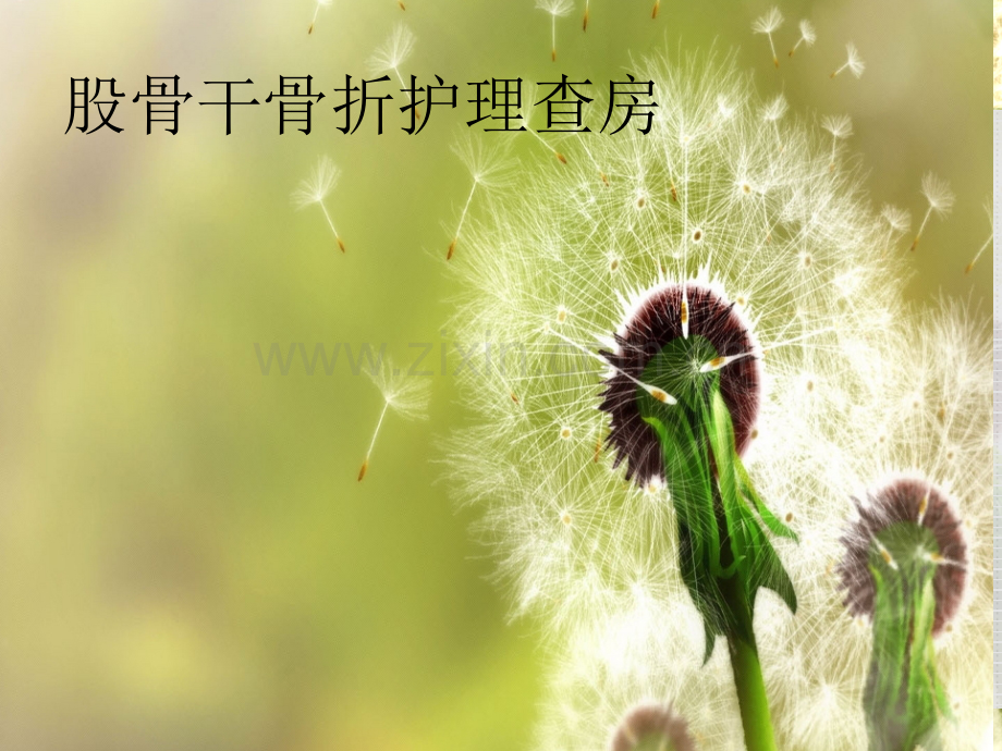 股骨干骨折查房.ppt_第1页