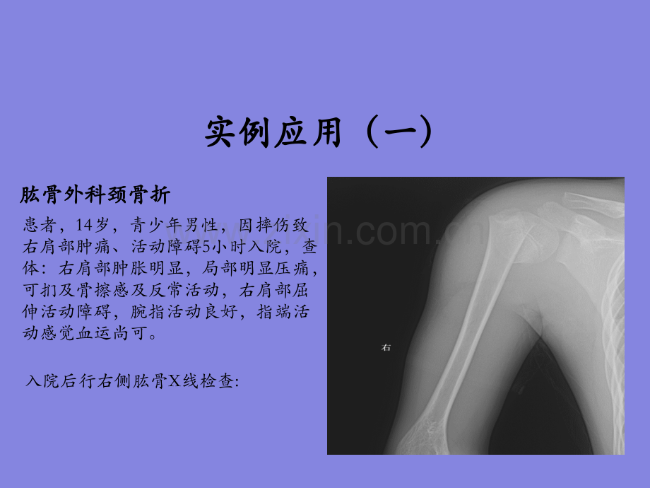 3D打印在骨科的应用.ppt_第1页