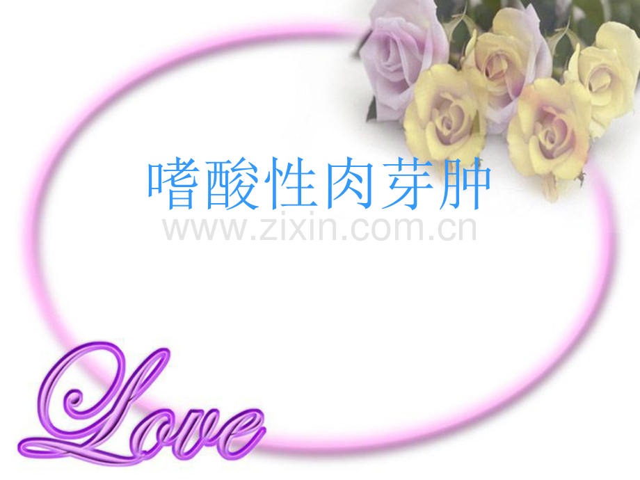 肺嗜酸性肉芽肿.ppt_第1页