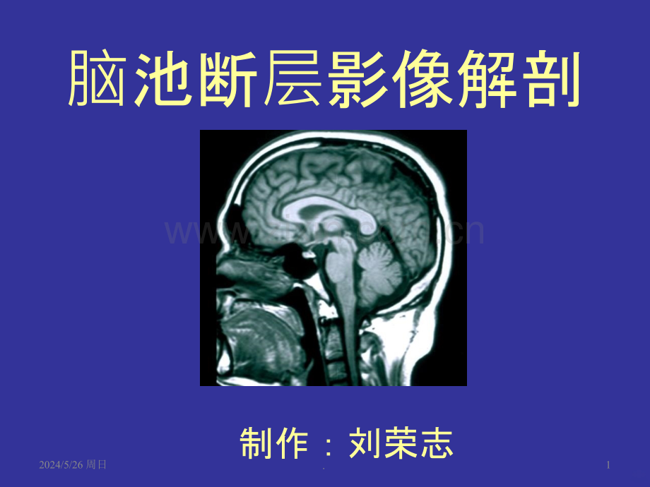 脑池断层影像解剖ppt课件.ppt_第1页