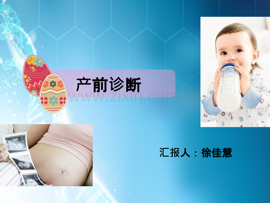 产前诊断ppt课件.ppt_第1页