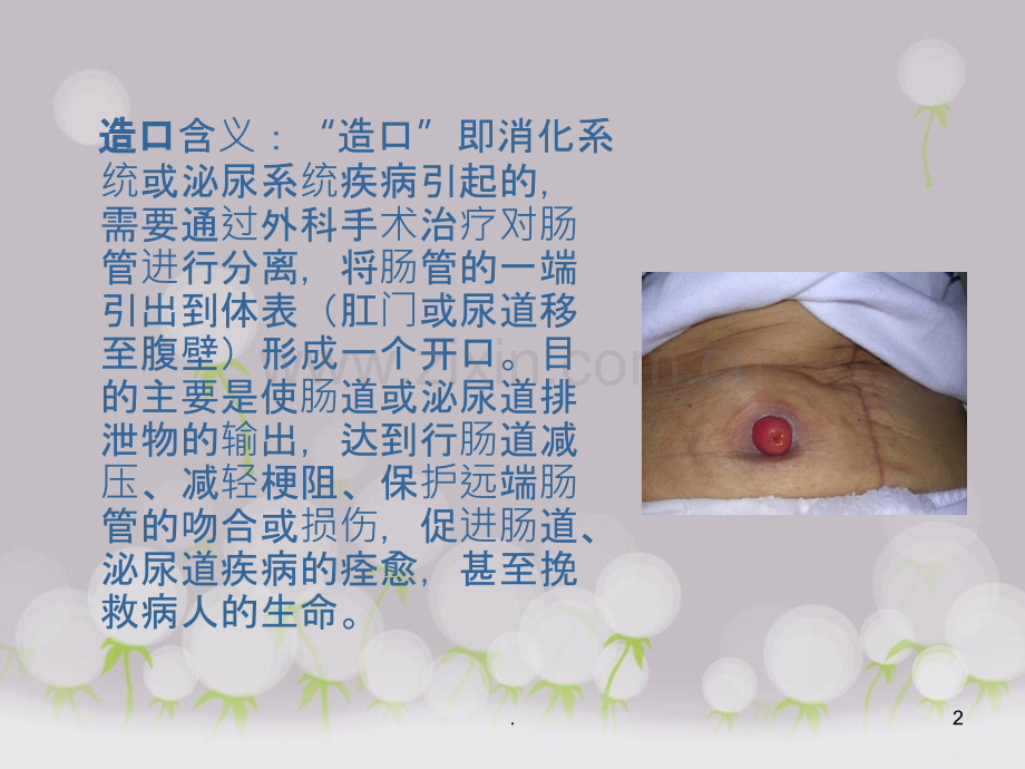 造口病人的生活护理-与指导.ppt_第2页