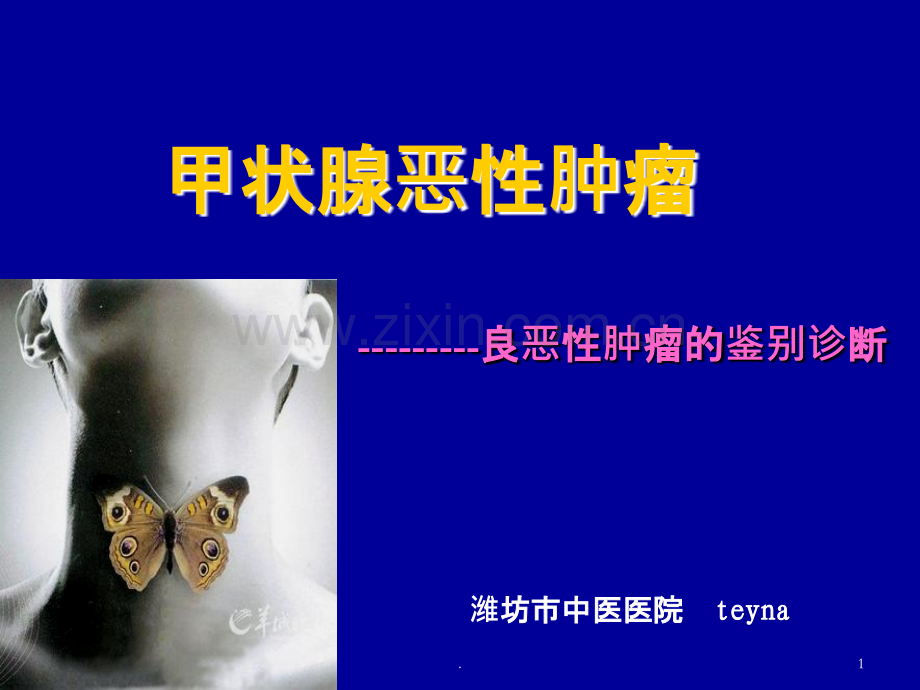 甲状腺癌讲课.ppt_第1页