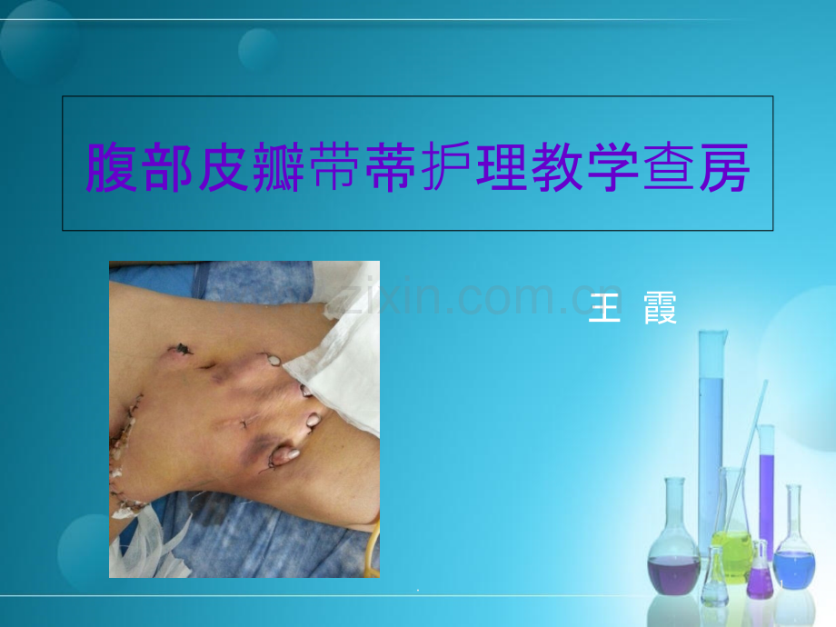 腹部带蒂皮瓣术护理查房.ppt_第1页