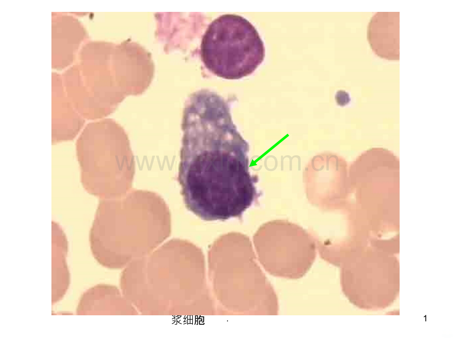 血液学检验典型细胞图谱.ppt_第1页