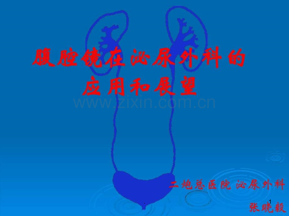腹腔镜在泌尿外科的应用和展望.ppt_第1页