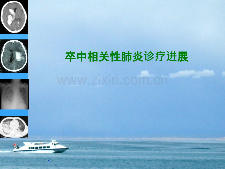 卒中相关性肺炎课件.ppt_第1页