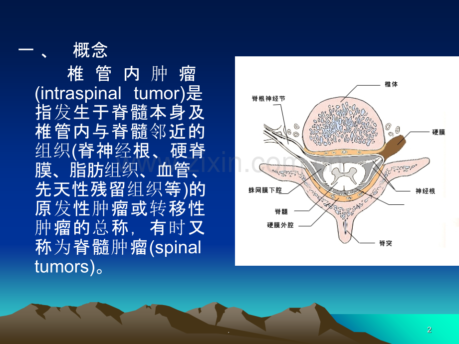 椎管内肿瘤课件.ppt_第2页