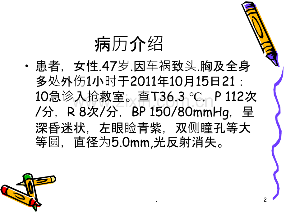 颅脑损伤病人的护理最后定ppt课件.ppt_第2页