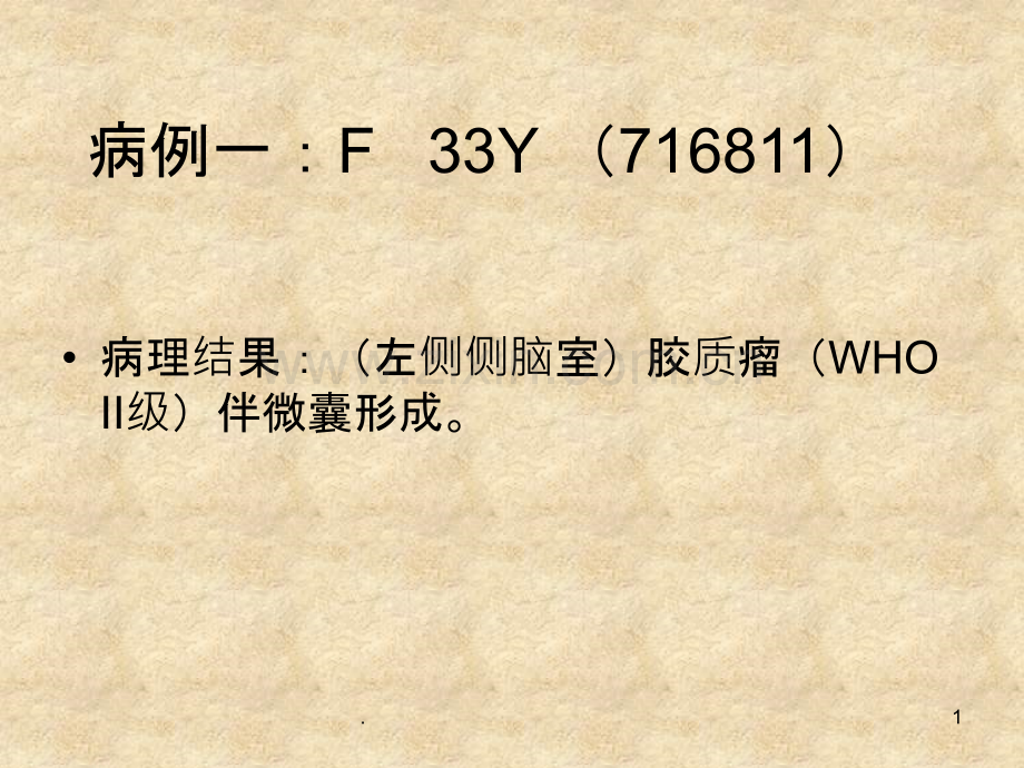 脑室占位.ppt_第1页