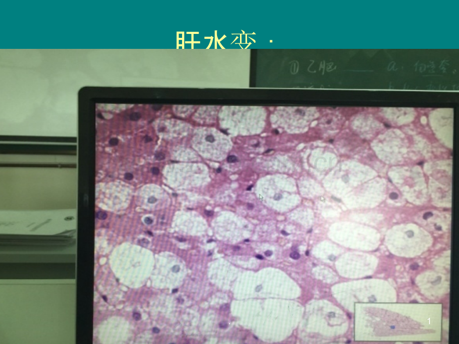 病理学实验切片考试图片ppt课件.ppt_第1页