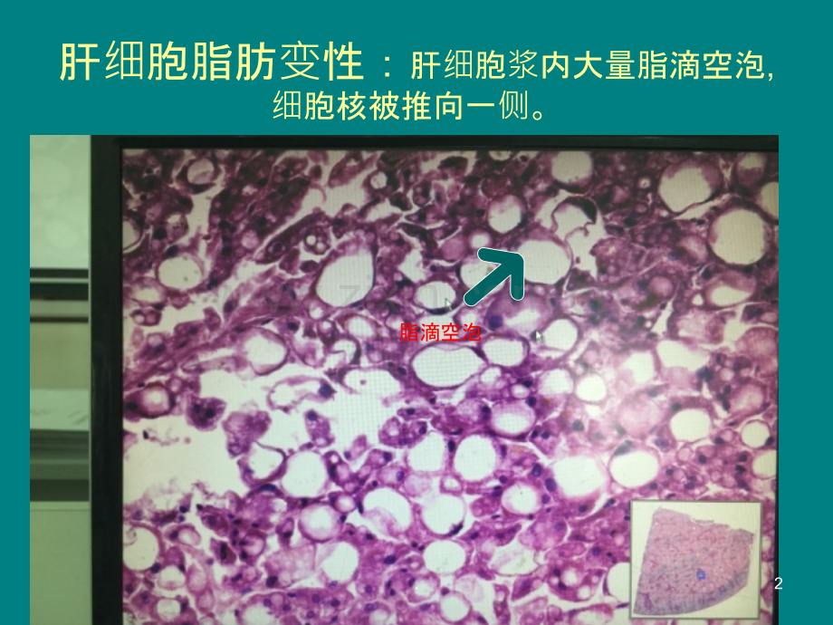病理学实验切片考试图片ppt课件.ppt_第2页
