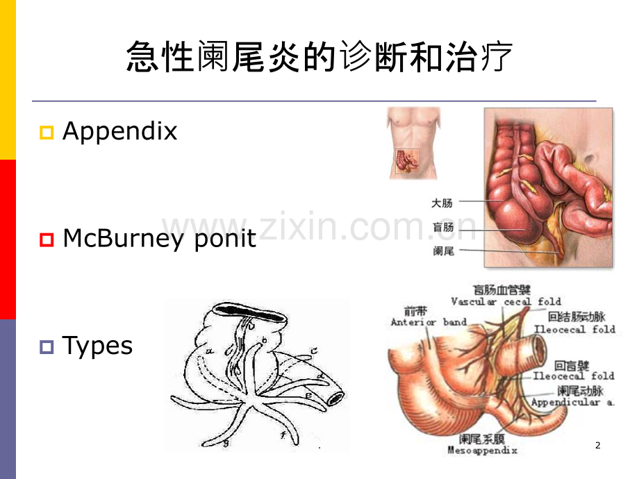 阑尾疾病上网版.ppt_第2页