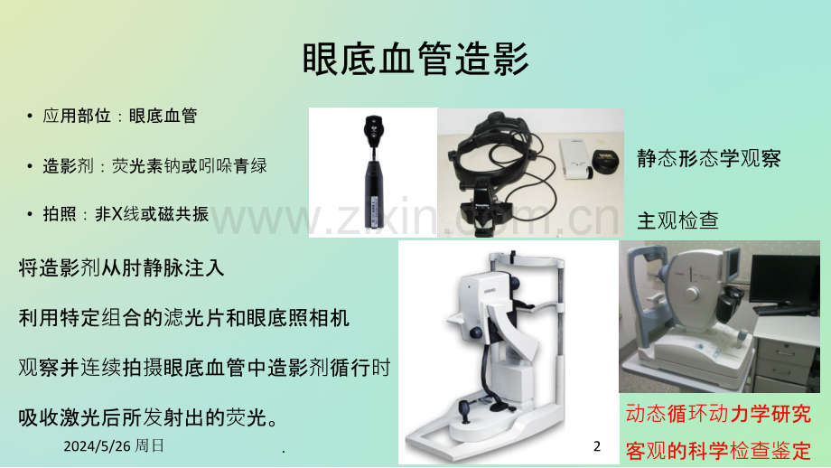 眼底造影FFA.ppt_第2页