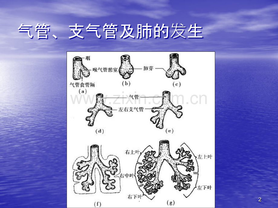 气管狭窄ppt课件.ppt_第2页
