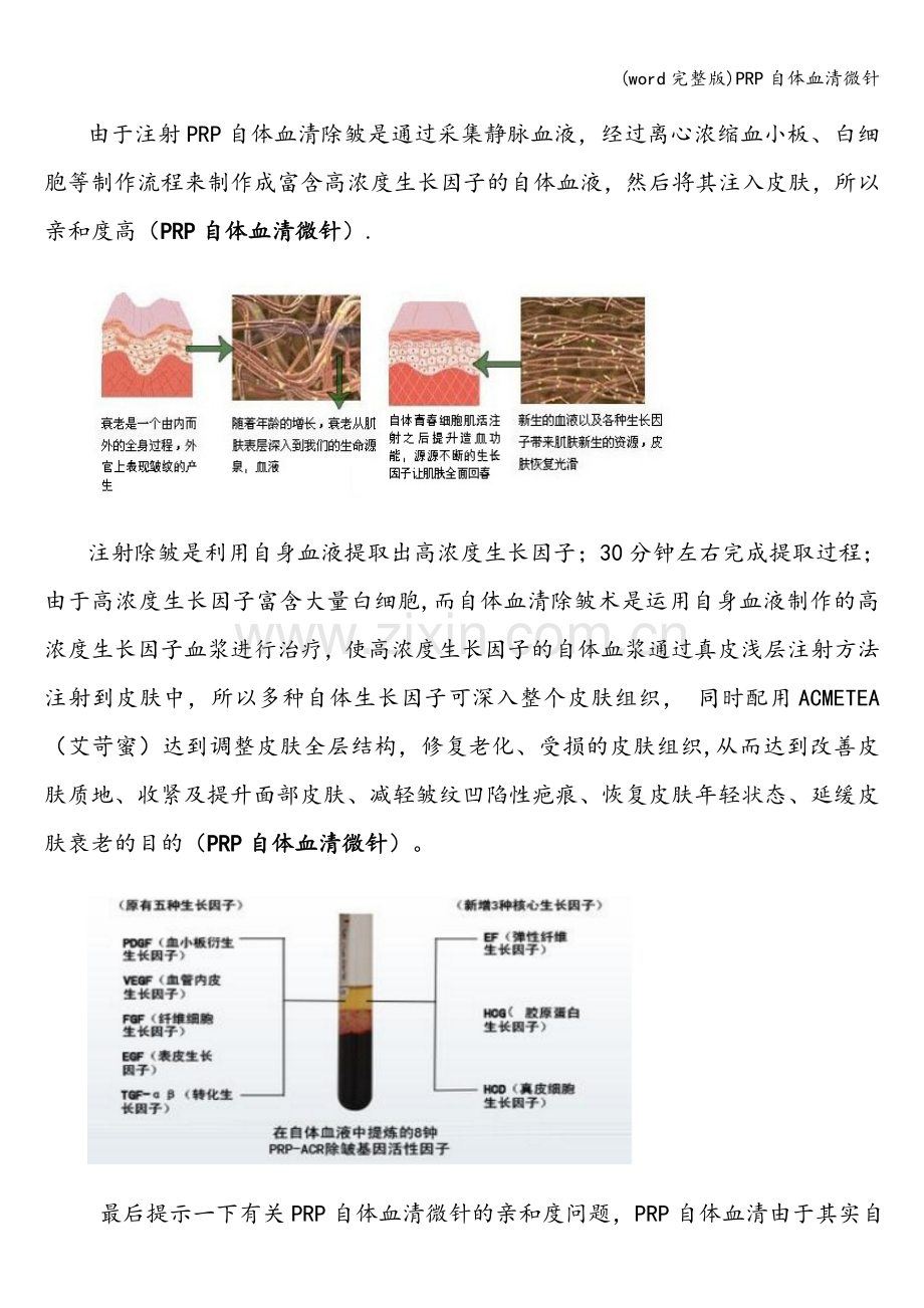 PRP自体血清微针.doc_第2页