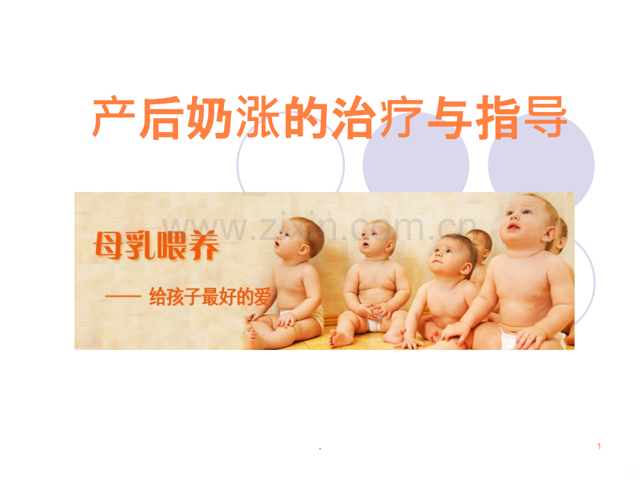产后奶涨的治疗与指导ppt课件.ppt_第1页