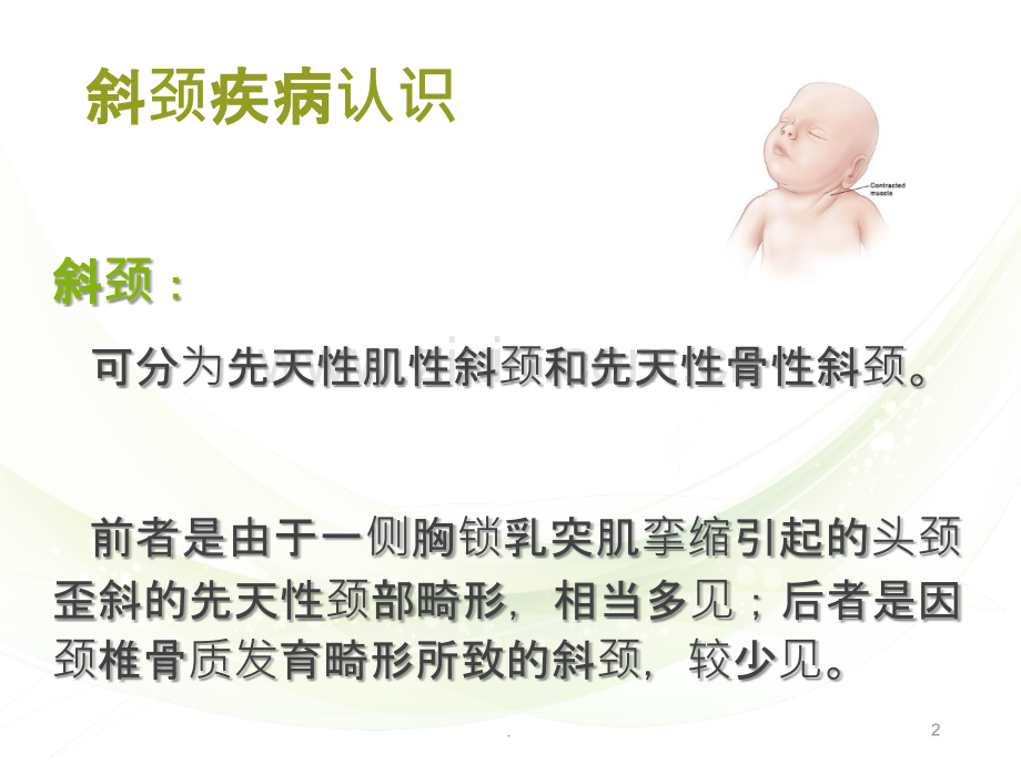 斜颈的治疗与护理.ppt_第2页