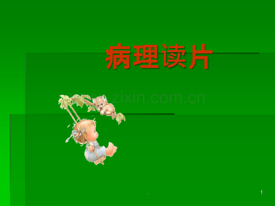四脑室肿瘤ppt课件.ppt_第1页