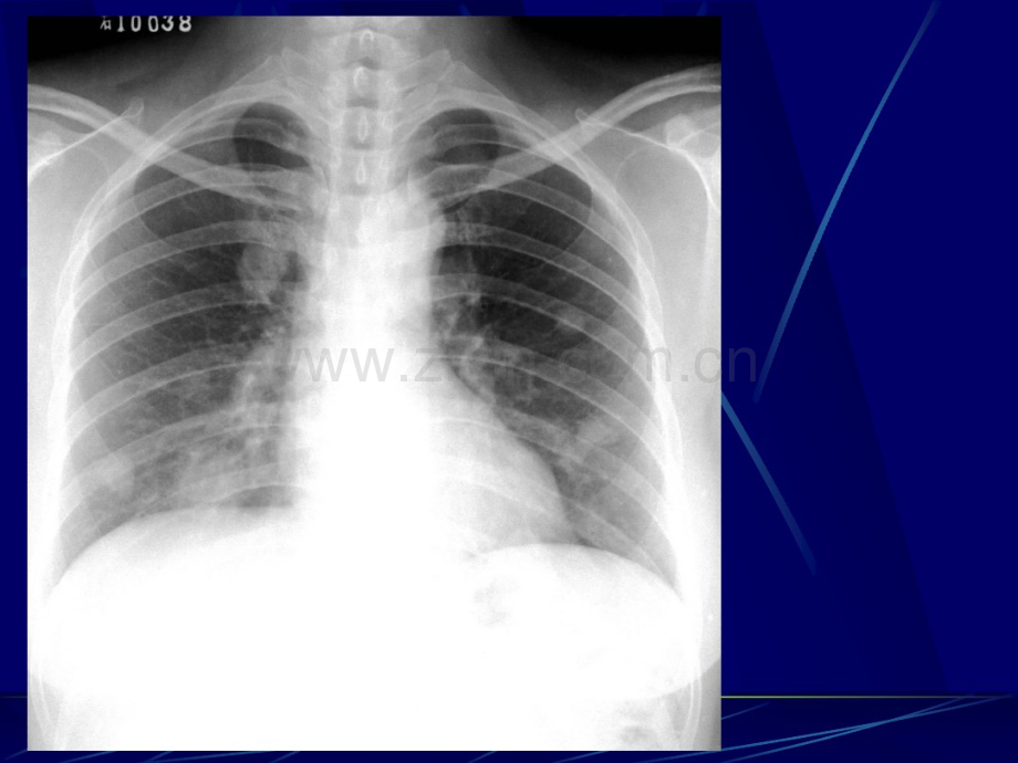 上海交通大学医学院附属瑞金医院-呼吸系统纵隔.pdf_第2页